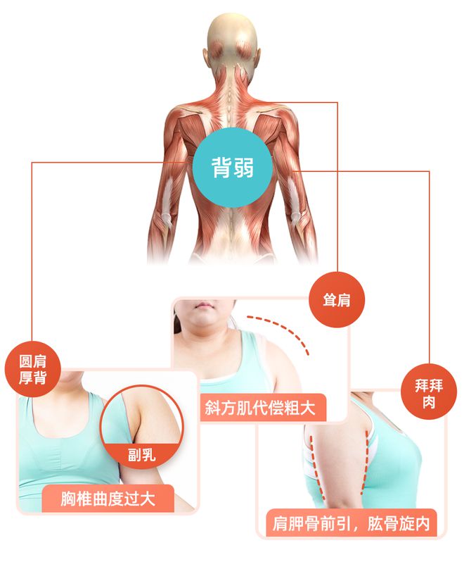 背薄了手臂细了肩不圆了练完这套动作更有气质了！(图1)