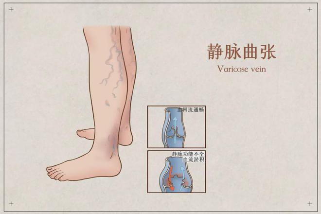 j9九游会健康科普 每天坚持“踮脚”8个好处不请自来！(图1)